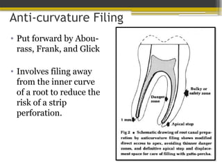 Anti-curvature Filing
• Put forward by Abou-
rass, Frank, and Glick
• Involves filing away
from the inner curve
of a root to reduce the
risk of a strip
perforation.
 
