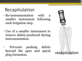 Recapitulation
• Re-instrumentation with a
smaller instrument following
each irrigation step.
• Use of a smaller instrument to
remove debris produced during
instrumentation.
• Prevents pushing debris
beyond the apex and apical
plug formation.
 