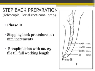 STEP BACK PREPARATION
(Telescopic, Serial root canal prep)
• Phase II
• Stepping back procedure in 1
mm increments
• Recapitulation with no. 25
file till full working length
 