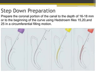 Step Down Preparation
Prepare the coronal portion of the canal to the depth of 16-18 mm
or to the beginning of the curve using Hedstroem files 15,20,and
25 in a circumferential filling motion.
 