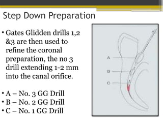 Step Down Preparation
• Gates Glidden drills 1,2
&3 are then used to
refine the coronal
preparation, the no 3
drill extending 1-2 mm
into the canal orifice.
• A – No. 3 GG Drill
• B – No. 2 GG Drill
• C – No. 1 GG Drill
 