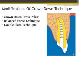 Modifications Of Crown Down Technique
• Crown Down Pressureless
• Balanced Force Technique
• Double Flare Technique
 