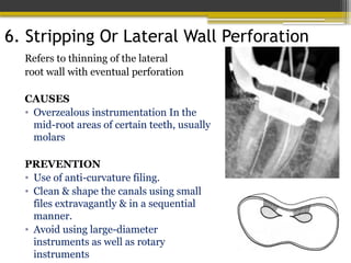 6. Stripping Or Lateral Wall Perforation
Refers to thinning of the lateral
root wall with eventual perforation
CAUSES
• Overzealous instrumentation In the
mid-root areas of certain teeth, usually
molars
PREVENTION
• Use of anti-curvature filing.
• Clean & shape the canals using small
files extravagantly & in a sequential
manner.
• Avoid using large-diameter
instruments as well as rotary
instruments
 