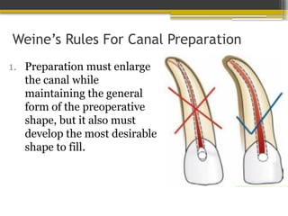 Weine’s Rules For Canal Preparation
1. Preparation must enlarge
the canal while
maintaining the general
form of the preoperative
shape, but it also must
develop the most desirable
shape to fill.
 