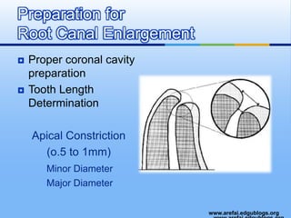 Proper coronal cavity preparationTooth Length DeterminationApical Constriction(o.5 to 1mm) Minor Diameter		Major DiameterPreparation for Root Canal Enlargement