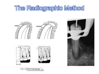 The Radiographic Method