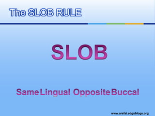 The SLOB RULESLOBBuccalOppositeLingualSame