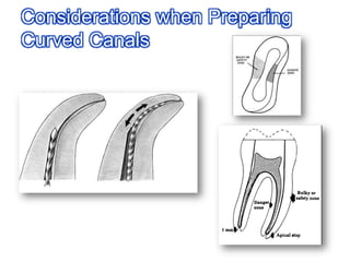 For instrument breakage