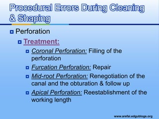 Use NiTi FilesConsiderations when Preparing Curved Canals