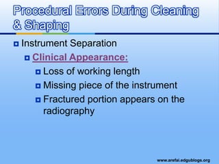 When Should You End Your Preparation?When the walls feel smooth and the dentin chips appear yellow white
