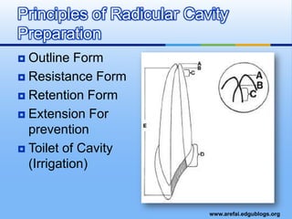 Outline FormResistance FormRetention FormExtension For preventionToilet of Cavity (Irrigation)Principles of Radicular Cavity Preparation