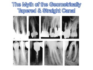 The Myth of the GeometricallyTapered & Straight Canal