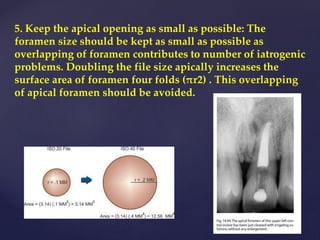 5. Keep the apical opening as small as possible: The
foramen size should be kept as small as possible as
overlapping of foramen contributes to number of iatrogenic
problems. Doubling the file size apically increases the
surface area of foramen four folds (πr2) . This overlapping
of apical foramen should be avoided.
 