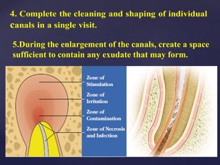 5.During the enlargement of the canals, create a space
sufficient to contain any exudate that may form.
 