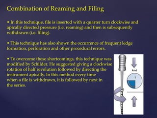 Combination of Reaming and Filing
• In this technique, file is inserted with a quarter turn clockwise and
apically directed pressure (i.e. reaming) and then is subsequently
withdrawn (i.e. filing).
• This technique has also shown the occurrence of frequent ledge
formation, perforation and other procedural errors.
• To overcome these shortcomings, this technique was
modified by Schilder. He suggested giving a clockwise
rotation of half revolution followed by directing the
instrument apically. In this method every time
when a file is withdrawn, it is followed by next in
the series.
 