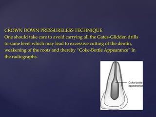 CROWN DOWN PRESSURELESS TECHNIQUE
One should take care to avoid carrying all the Gates-Glidden drills
to same level which may lead to excessive cutting of the dentin,
weakening of the roots and thereby “Coke-Bottle Appearance” in
the radiographs.
 