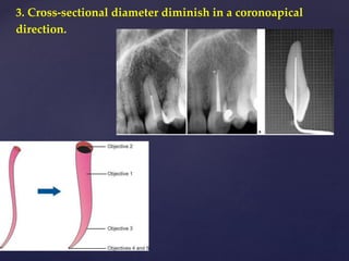 3. Cross-sectional diameter diminish in a coronoapical
direction.
 