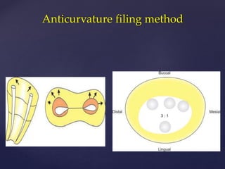 Anticurvature filing method
 