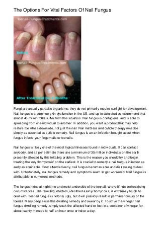 The Options For Vital Factors Of Nail Fungus




Fungi are actually parasitic organisms; they do not primarily require sunlight for development.
Nail fungus is a common skin dysfunction in the US, and up to date studies recommend that
almost 40 million folks suffer from this situation. Nail fungus is contagious, and is able to
spreading from one individual to another. In addition, you want a product that may help
restore the whole downside, not just the nail. Nail mattress and cuticle therapy must be
simply as essential as cuticle remedy. Nail fungus is an an infection brought about when
fungus infects your fingernails or toenails.


Nail fungus is likely one of the most typical illnesses found in individuals. It can contact
anybody, and as per estimate there are a minimum of 35 million individuals on the earth
presently affected by this irritating problem. This is the reason you should try and begin
treating the 'onychomycosis' on the earliest. It is crucial to remedy a nail fungus infection as
early as attainable. If not attended early, nail fungus becomes sore and distressing to deal
with. Unfortunately, nail fungus remedy and symptoms seem to get worsened. Nail fungus is
attributable to numerous methods.


The fungus hides at nighttime and moist underside of the toenail, where itfinds perfect rising
circumstances. The resulting infection, identified asonychomycosis, is extremely tough to
deal with. Toenail fungus is notonly ugly, but it will possibly result in permanent injury of the
toenail. Many people use this dwelling remedy and swear by it. To strive the vinegar nail
fungus dwelling remedy, simply soak the affected hand or foot in a container of vinegar for
about twenty minutes to half an hour once or twice a day.
 
