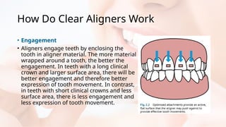 Clear Aligner Science Behind Invisibility and Oppurtunity.pptx