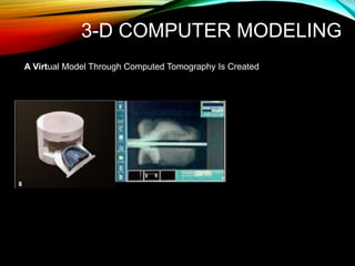 3-D COMPUTER MODELING
A Virtual Model Through Computed Tomography Is Created
 