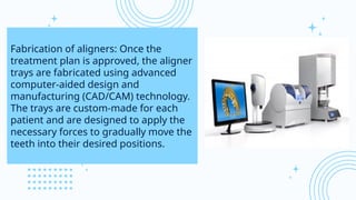 Clear Aligners, Orthodontics, SDC, by Dr. Tannu Singh | PPT