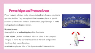 PowerridgesandPressureAreas
Power ridge: is a feature on the aligners that delivers force on a tooth at a
specified position. They are engineered corrugations placed at specific
locations to enhance the undercut near the labial gingival margin of teeth
undergoing torqueing movements.
Reasons for use:
•Accomplish an in and out tipping of the front teeth.
• Add torque (provide additional force as close to the gingival
margin) to move the root and the crown of the tooth and push the
teeth into their planned position.
•to stiffen the gingival third of the aligner to make it more resilient;
 