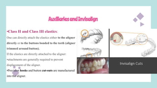 AuxiliariesandInvisalign
•Class II and Class III elastics:
One can directly attach the elastics either to the aligner
directly or to the buttons bonded to the teeth (aligner
trimmed around button).
If the elastics are directly attached to the aligner:
•attachments are generally required to prevent
displacement of the aligner.
•Precision hooks and button cut-outs are manufactured
into the aligner.
 