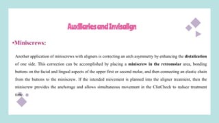 AuxiliariesandInvisalign
•Miniscrews:
Another application of miniscrews with aligners is correcting an arch asymmetry by enhancing the distalization
of one side. This correction can be accomplished by placing a miniscrew in the retromolar area, bonding
buttons on the facial and lingual aspects of the upper first or second molar, and then connecting an elastic chain
from the buttons to the miniscrew. If the intended movement is planned into the aligner treatment, then the
miniscrew provides the anchorage and allows simultaneous movement in the ClinCheck to reduce treatment
time.
 