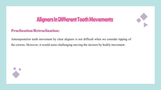 AlignersinDifferentToothMovements
Proclination/Retroclination:
Anteroposterior teeth movement by clear aligners is not difficult when we consider tipping of
the crowns. However, it would seem challenging moving the incisors by bodily movement.
 