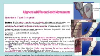 AlignersinDifferentToothMovements
Rotational Tooth Movement
Problem 1: Correcting rotations with aligners can be problematic because
the aligner material is incapable of being distorted in a manner that can
produce significant rotational movement.
Solution:
 Beveled attachments with the bevel turned 90 degrees (i.e.,
mesiodistal) would provide a surface that allows the aligner to rotate
teeth.
 Auxiliaries can be used before, during or after aligner ttt
Problem 2: the tooth root is not a cylinder. Because of dilacerations and root surface
variations, the computer software cannot adequately estimate the true rotational long axis and
estimating the proper rate of tooth movement becomes impossible. The result is either no
movement or undesirable tooth movements.
Solution: With the advent of the newer optimized attachments, the predictability of rotational
movements have significantly improved. Optimized attachments are now available for all
bicuspids and cuspids. The default for the bicuspids and cuspids is rotation correction greater
than 5 degrees in either direction. Molars and incisors do not have engineered rotation
attachments to date. (Note that the upper lateral incisor attachment is not a rotation correction
attachment; rather, it is designed for extrusion in combination with root or crown tip.)
 