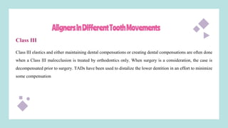 AlignersinDifferentToothMovements
Class III
Class III elastics and either maintaining dental compensations or creating dental compensations are often done
when a Class III malocclusion is treated by orthodontics only. When surgery is a consideration, the case is
decompensated prior to surgery. TADs have been used to distalize the lower dentition in an effort to minimize
some compensation
 