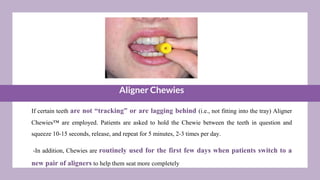 Aligner Chewies
If certain teeth are not “tracking” or are lagging behind (i.e., not fitting into the tray) Aligner
Chewies™ are employed. Patients are asked to hold the Chewie between the teeth in question and
squeeze 10-15 seconds, release, and repeat for 5 minutes, 2-3 times per day.
-In addition, Chewies are routinely used for the first few days when patients switch to a
new pair of aligners to help them seat more completely
 