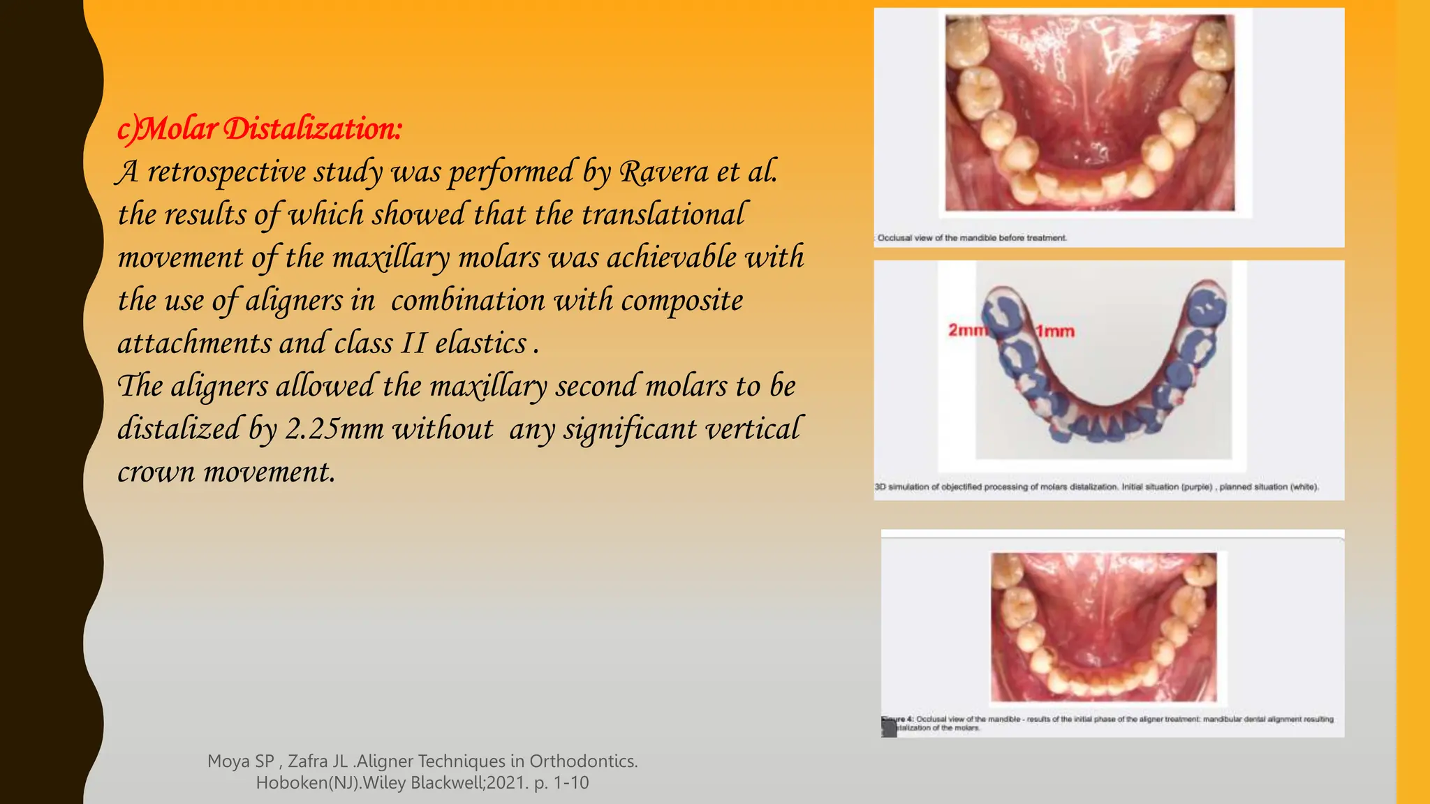 CLEAR ALIGNER THERAPY IN ORTHODONTICS .pptx