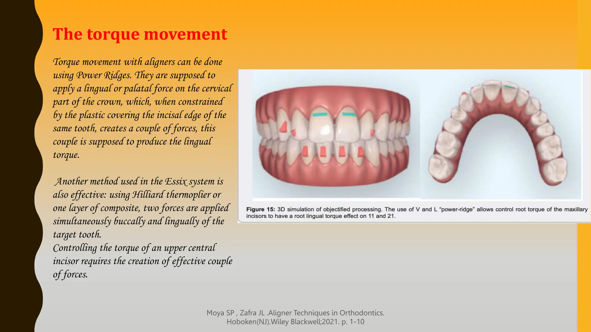 CLEAR ALIGNER THERAPY IN ORTHODONTICS .pptx