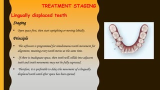 CLEAR ALIGNER THERAPY IN ORTHODONTICS .pptx