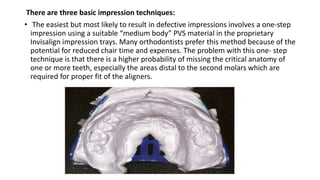 There are three basic impression techniques:
• The easiest but most likely to result in defective impressions involves a one-step
impression using a suitable “medium body” PVS material in the proprietary
Invisalign impression trays. Many orthodontists prefer this method because of the
potential for reduced chair time and expenses. The problem with this one- step
technique is that there is a higher probability of missing the critical anatomy of
one or more teeth, especially the areas distal to the second molars which are
required for proper fit of the aligners.
 