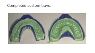 Clear aligner treatment | PPTX