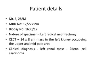 Patient details
• Mr. S, 28/M
• MRD No: 17/227994
• Biopsy No: 1630/17
• Nature of specimen - Left radical nephrectomy
• C...