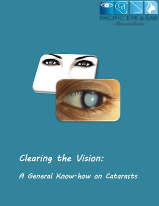 Clearing the Vision:
A General Know-how on Cataracts

 