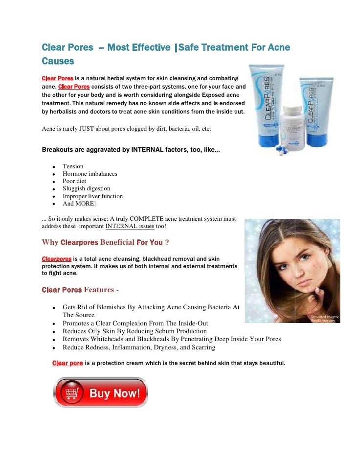 Clear pores Complete Acne Treatment
