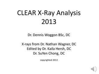 CLEAR X-Ray Analysis
2013
Dr. Dennis Woggon BSc, DC
X-rays from Dr. Nathan Wagner, DC
Edited by Dr. Kaila Hersh, DC
Dr. SuYen Chong, DC
copyrighted 2013
 