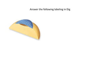 Answer the following labeling in Dig
 