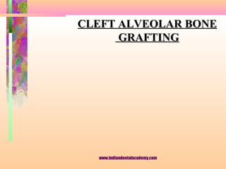 CLEFT ALVEOLAR BONE
GRAFTING

www.indiandentalacademy.com

 