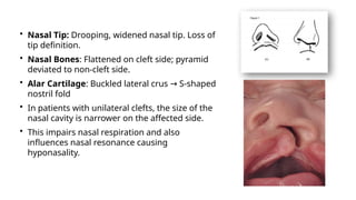 Management of Cleft Lip and Palate - Orthodontics | PPTX