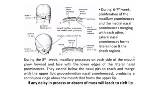 Management of Cleft Lip and Palate - Orthodontics | PPTX