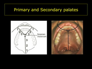 Primary and Secondary palates

 
