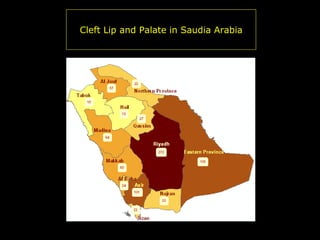 Cleft Lip and Palate in Saudia Arabia

 