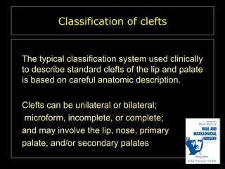 Classification of clefts

The typical classification system used clinically
to describe standard clefts of the lip and palate
is based on careful anatomic description.
Clefts can be unilateral or bilateral;
microform, incomplete, or complete;
and may involve the lip, nose, primary
palate, and/or secondary palates

 