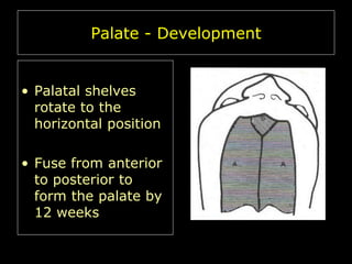 Palate - Development

• Palatal shelves
rotate to the
horizontal position
• Fuse from anterior
to posterior to
form the palate by
12 weeks

 